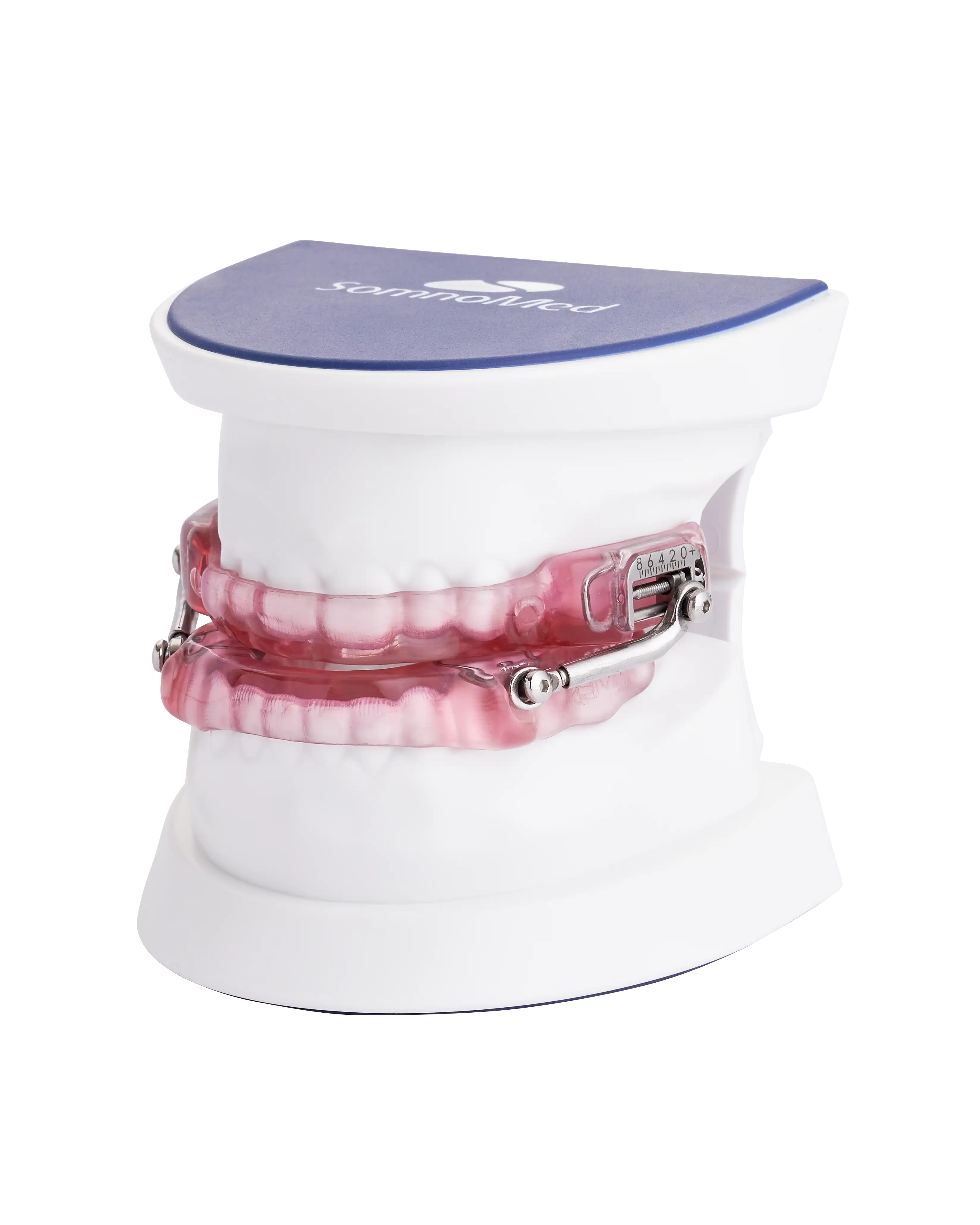 SomnoMed Herbst device on model